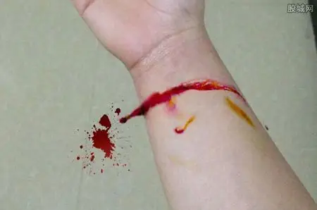 有谁能帮我把第二张图的伤口p到第一张图吗 ?谢谢