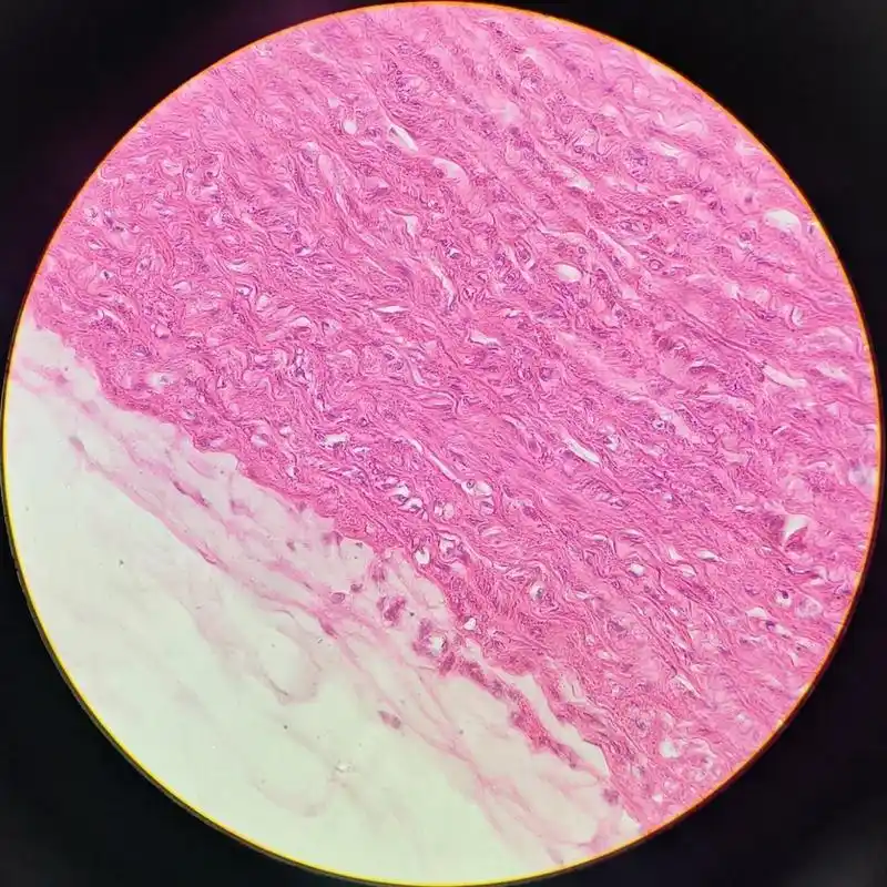 组胚绘图-大动脉 p3 内膜 p4 中膜 p5 外膜 p6-p7 弹性染色