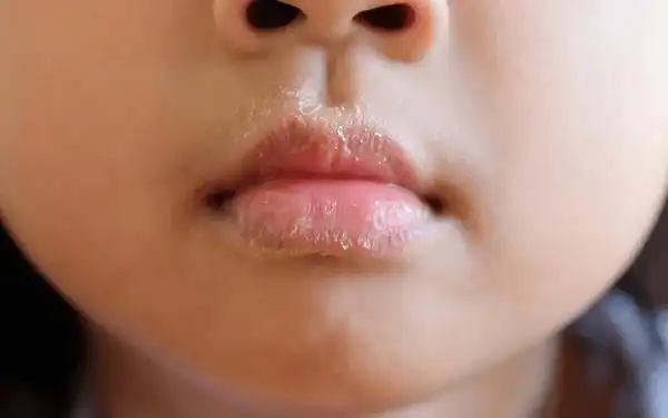 怎么改掉宝宝长期咬下嘴唇的习惯?求过来人妙招?