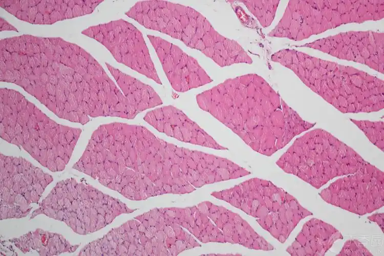 【求助】骨骼肌病理切片