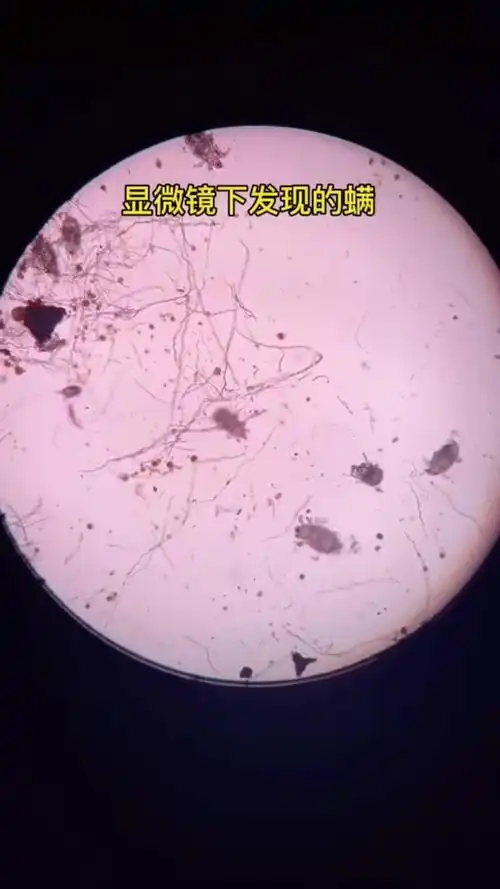 3天不晒被,百万螨虫陪你睡,看看螨虫放大后长什么样子,一定要定期除螨