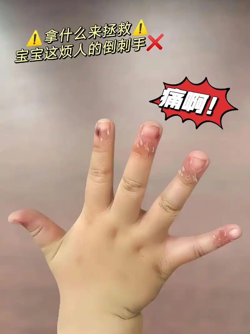 贝德美儿童指缘油 就算啃咬手指也不怕!