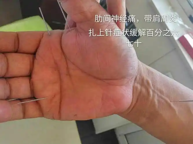 八卦五行手针相册第四集