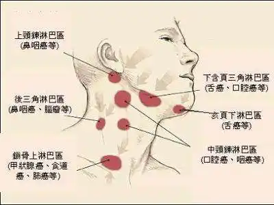 颈部淋巴脖子淋巴脸下淋巴结在哪里脸部淋巴结