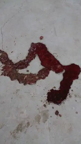 昨晚九点金毛上吐下泻,不知道几点又拉血了,一大滩怎么办,还有救吗