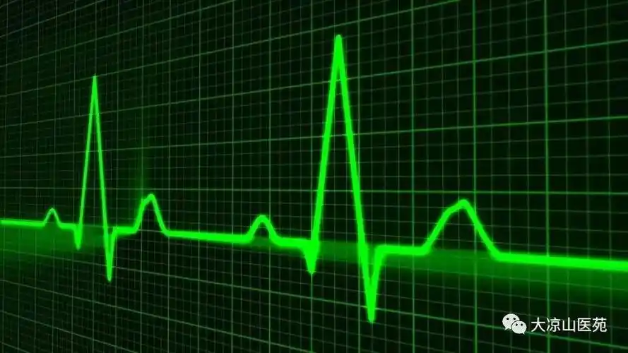 工作的状态就像心电图.