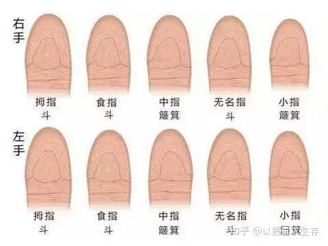指尖上的手纹分为斗和簸箕,斗纹又称螺纹,涡纹,斗纹呈圆圈状.