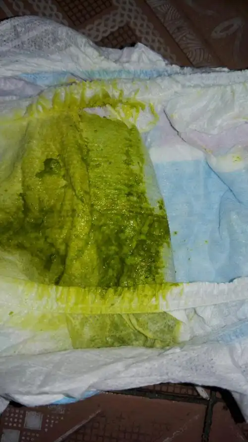 宝宝大便绿色怎么回事