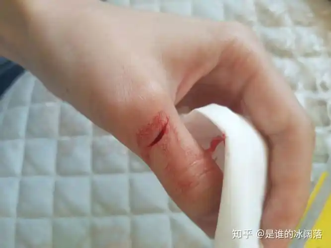 手被刀切了个深口子应该怎么处理?