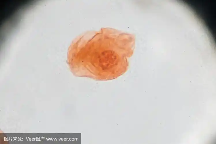 猪带绦虫卵的光镜观察