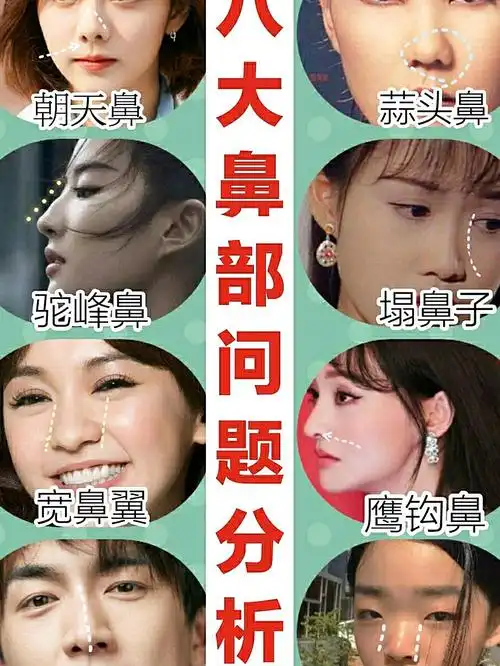 而鼻子又在面部的中心部位(参考三庭五眼标准),鼻子不出彩,那么颜值就