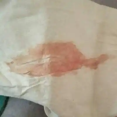 怀孕两个半月了今天上厕所有点见红怎麼回事?