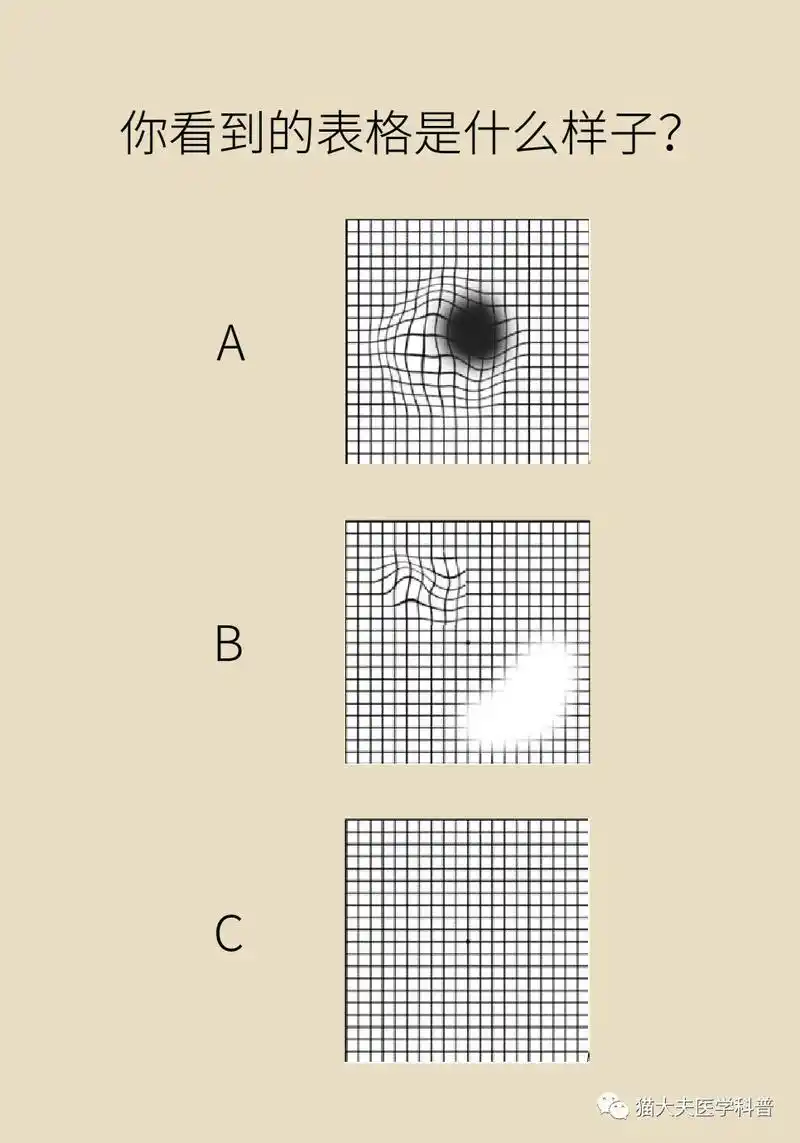 4张好玩的测试图1分钟测出眼睛是否正常