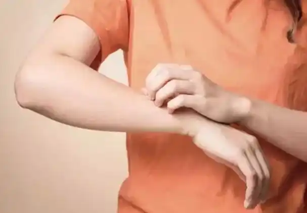 这些病人在被窝一热时,就感觉瘙痒得很厉害,抓得很厉害.