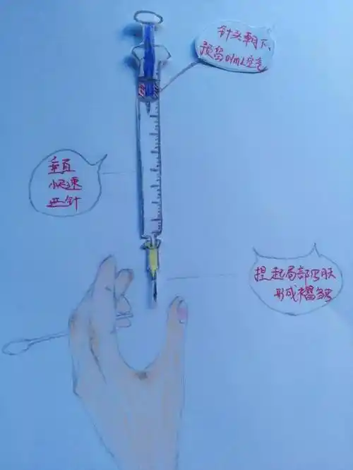 低分子肝素注射避免皮下出血改进方法不妨试一试