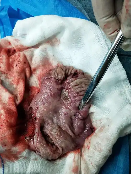 多学科协作——挽救患者生命