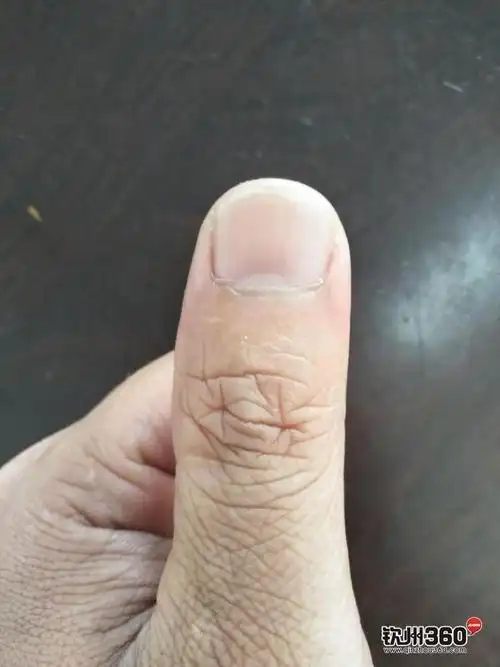 钦州360的朋友们,帮我看下我这样的指甲是有福气还是比较苦命呢?