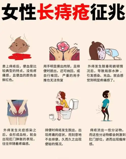 痔疮自救指南,有这些征兆的女生一定要看!