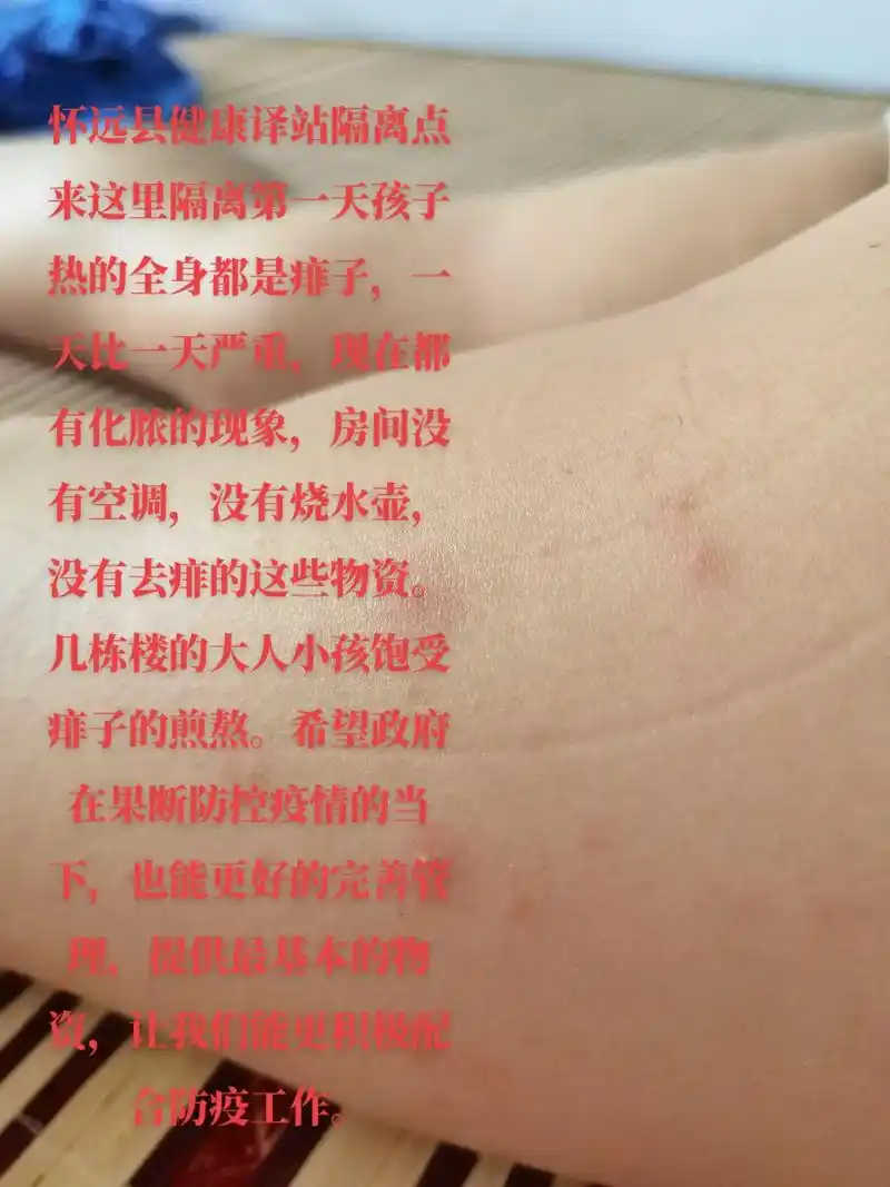 怀远县健康译站隔离点 来这里隔离第一天孩子热的全身都是痱子, - 抖