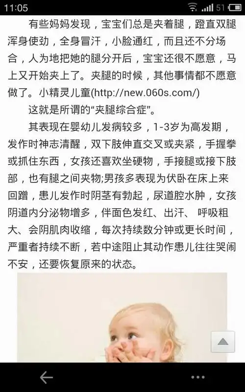 夹腿综合征,你们听说过吗?