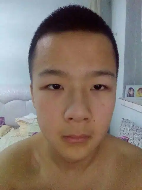 根本没必要做手术.眼角下垂的男人面相.手法有,但是在这里讲不清.