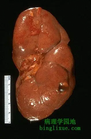 正常成年人肾脏外观
