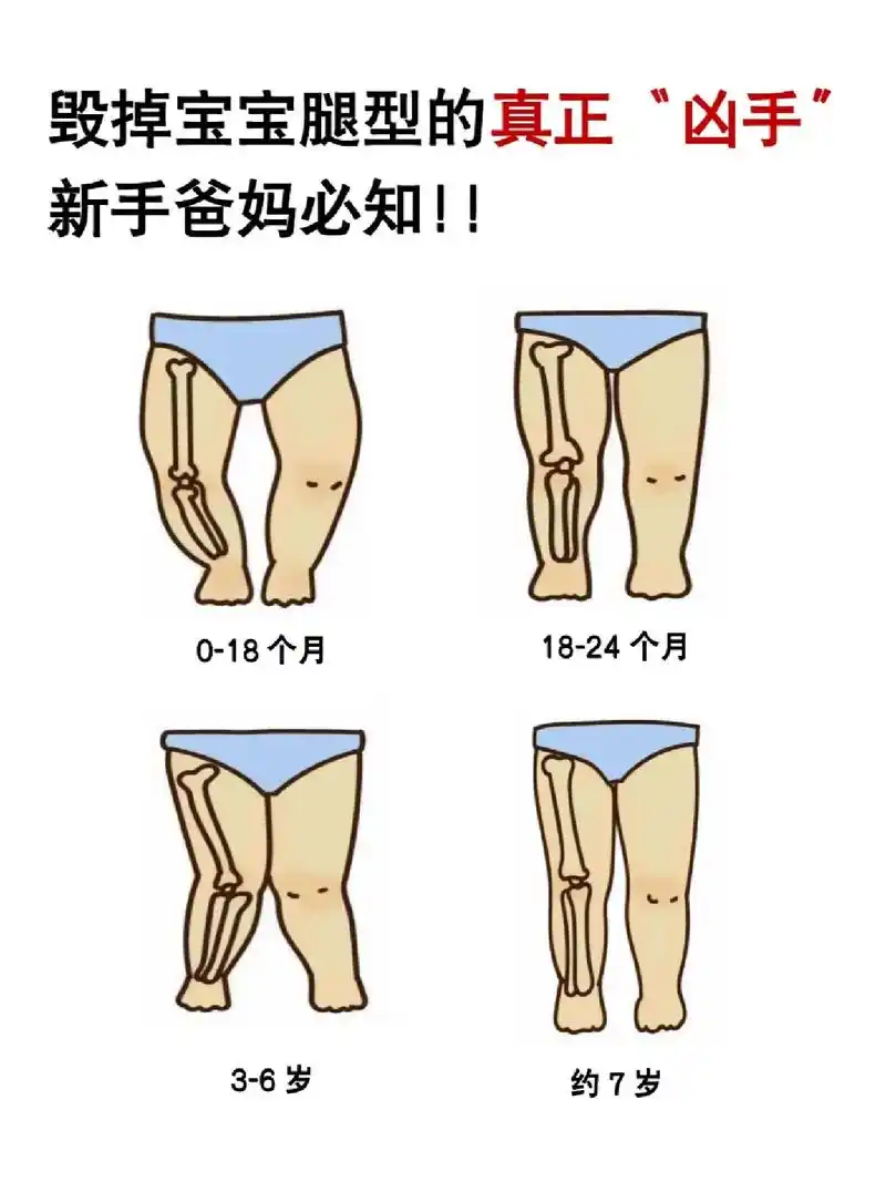 宝宝腿型发育变化! - 抖音