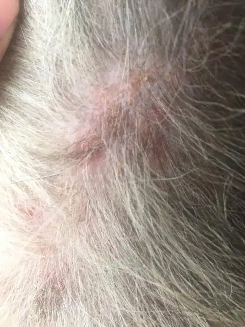 狗狗身上有这种情况,请问怎么治疗,是螨虫还是真菌还是什么