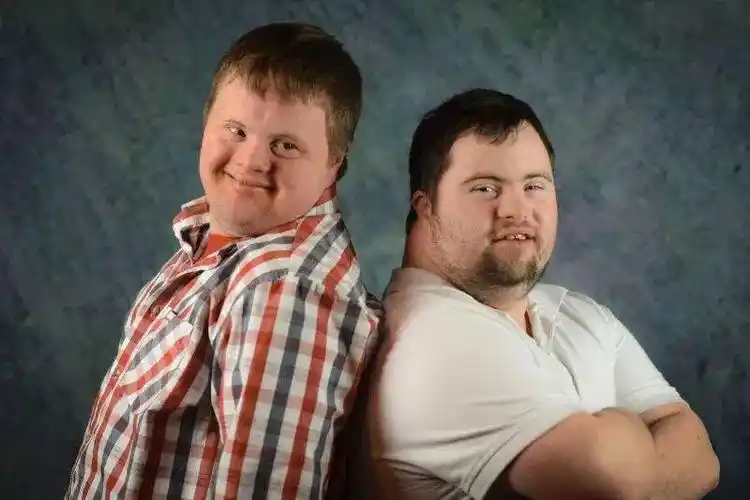 这张古怪的"国际脸"背后,是染色体变异引来的畸形与死亡