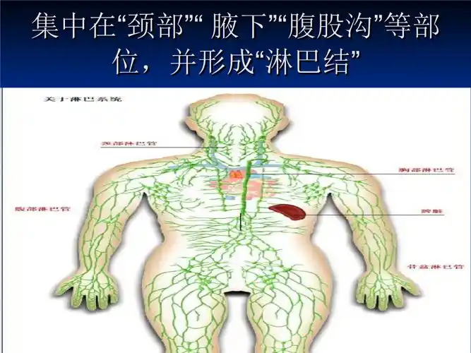 淋巴风暴 ding.ppt