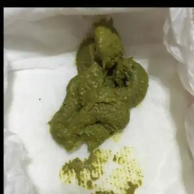 宝宝刚一个月,拉的大便怎麼是这种颜色?求解