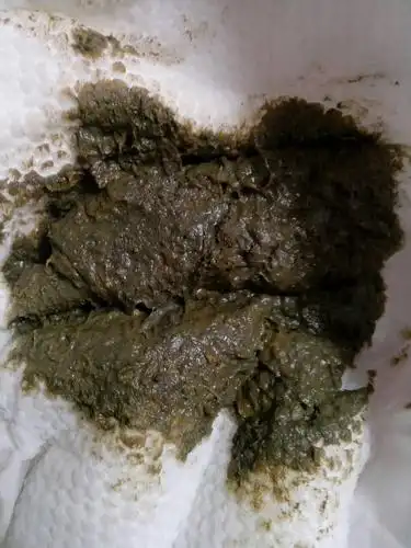 五个月的小孩,有时候大便是这种色的,现在吃配方奶粉和米粉一起,请问