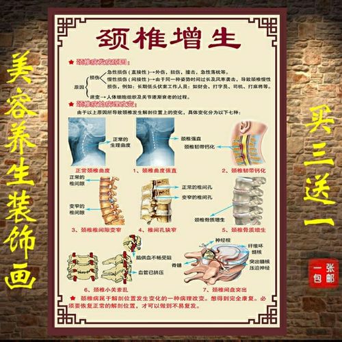 中医养生馆美容院颈椎增生发病原因挂画挂图宣传海报定制kt板包邮