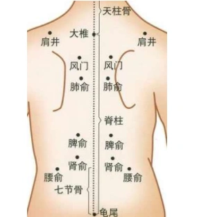 拔罐减肥拔哪个部位图建议选择这些穴位拔罐