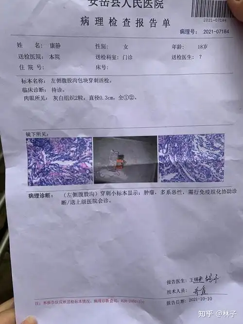 知道自己癌症晚期会有什么感觉