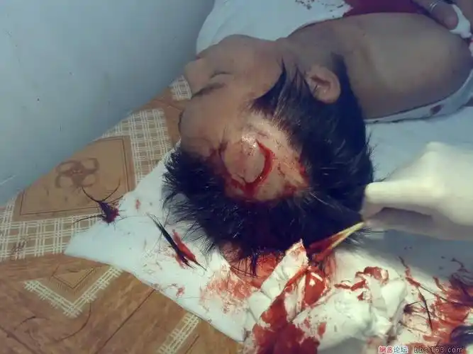 广东省饶平新丰中学发生学生砍人恶劣事件