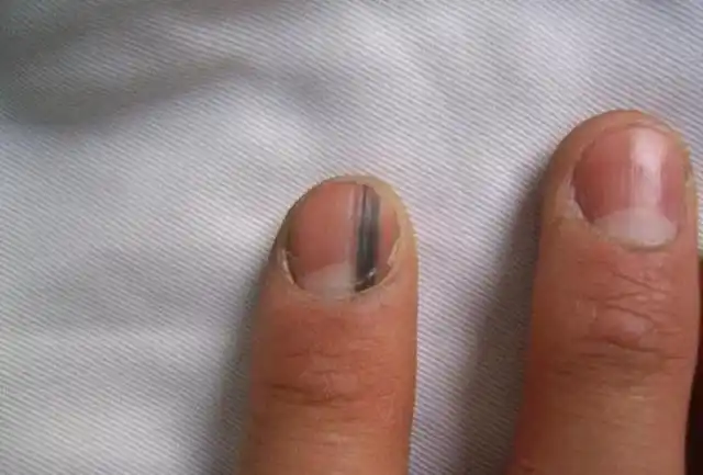 少有人知的"小白菜",是"天然养肝王",煮水喝,肝病绕道走