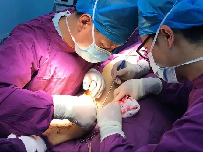 日间手术中心今日完成首例大隐静脉高位结扎及分段剥脱术