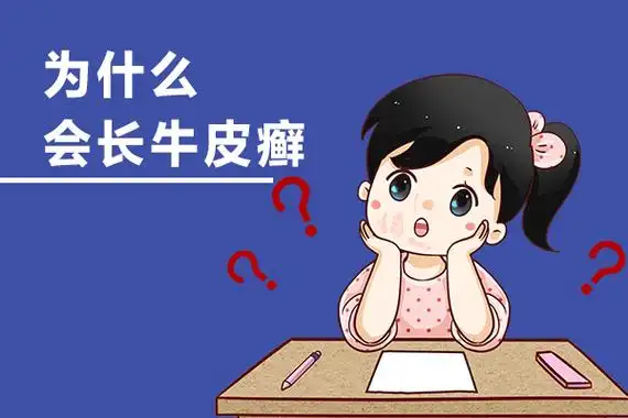 牛皮癣