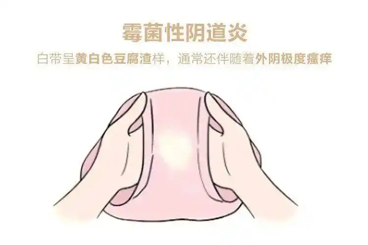 原因竟是因为._医生_明好_尿道