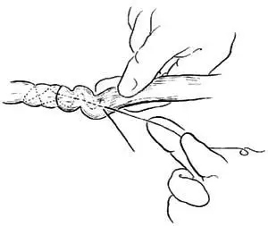 【伸腕肌腱缝合术】伸腕肌腱缝合术手术详细步骤,伸腕肌腱缝合术手术