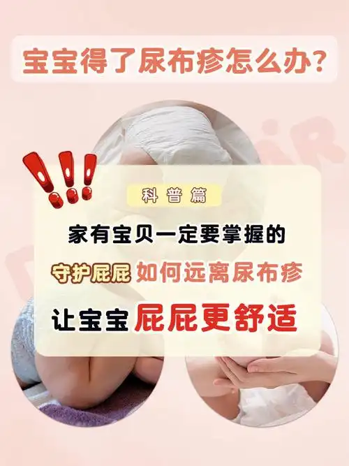 72科普一篇教你搞定新生儿尿布疹60
