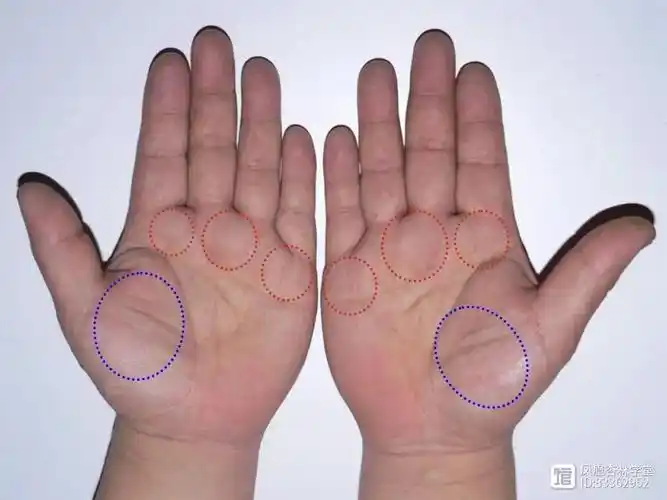 观手诊病,金玉良田之贵相竟与高脂血症相关?