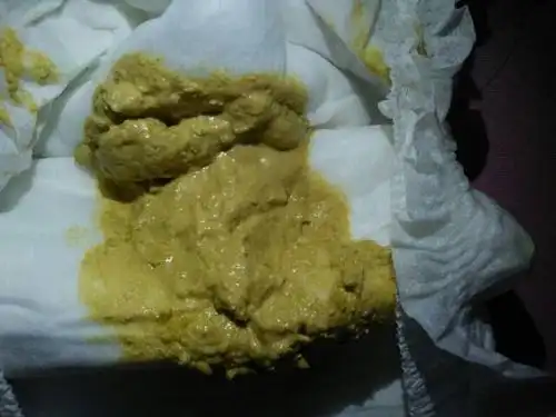 宝宝容易消化不良拉肚子,这两天粑粑颜色泛白的黄色,粘臭怎么回事?