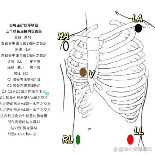 实习护士必备|心电监护仪的使用 00后小护士上班92的第12天 	 扫床