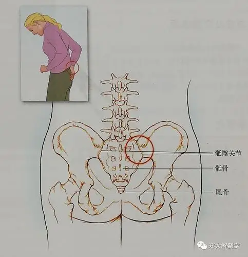 六种引起腰椎和骶髂关节的疼痛综合征