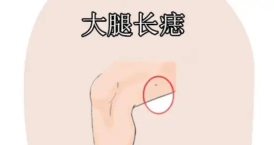 身上5颗"皇帝"痣,有车有房,有财有势,儿女双全,婚姻幸福!