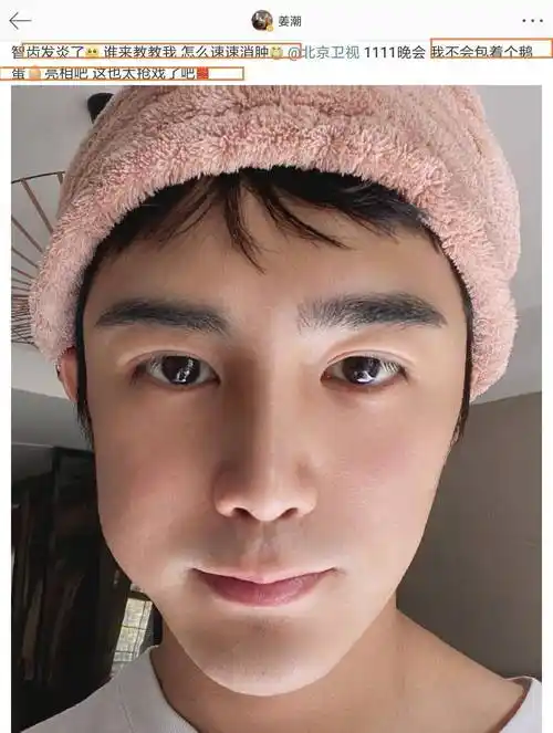 姜潮智齿发炎,肿成鹅蛋脸.