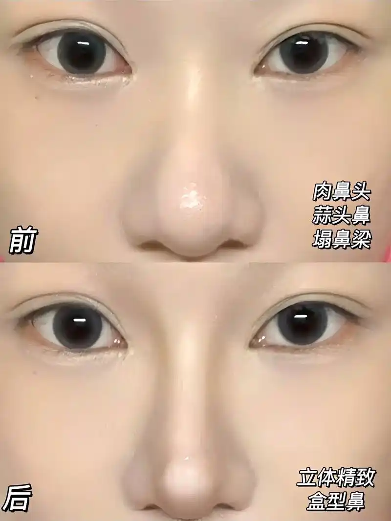 素描骨骼修容法!快码住.素描骨骼修容法!美术生的思路修容!本 - 抖音