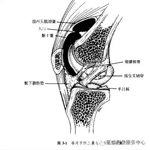 (一)髌上囊:bursa suprapatellaris 为膝部最大的滑液囊,位 …